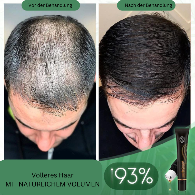 RamoraVive™ — Unlock Lush, Head-Turning Hair That Powers Your Confidence