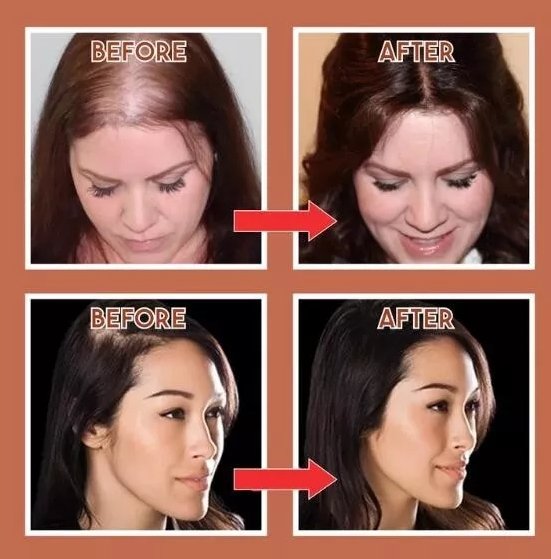 VelouraLift™ — Instantly Boost Your Confidence with Fuller, Flawless Hair