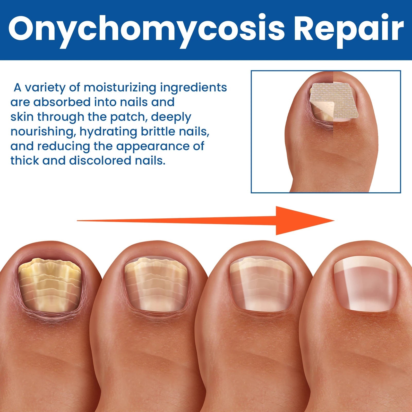 RestoreNail™ — Effortless Healing for Nails That Spark Confidence and Strength