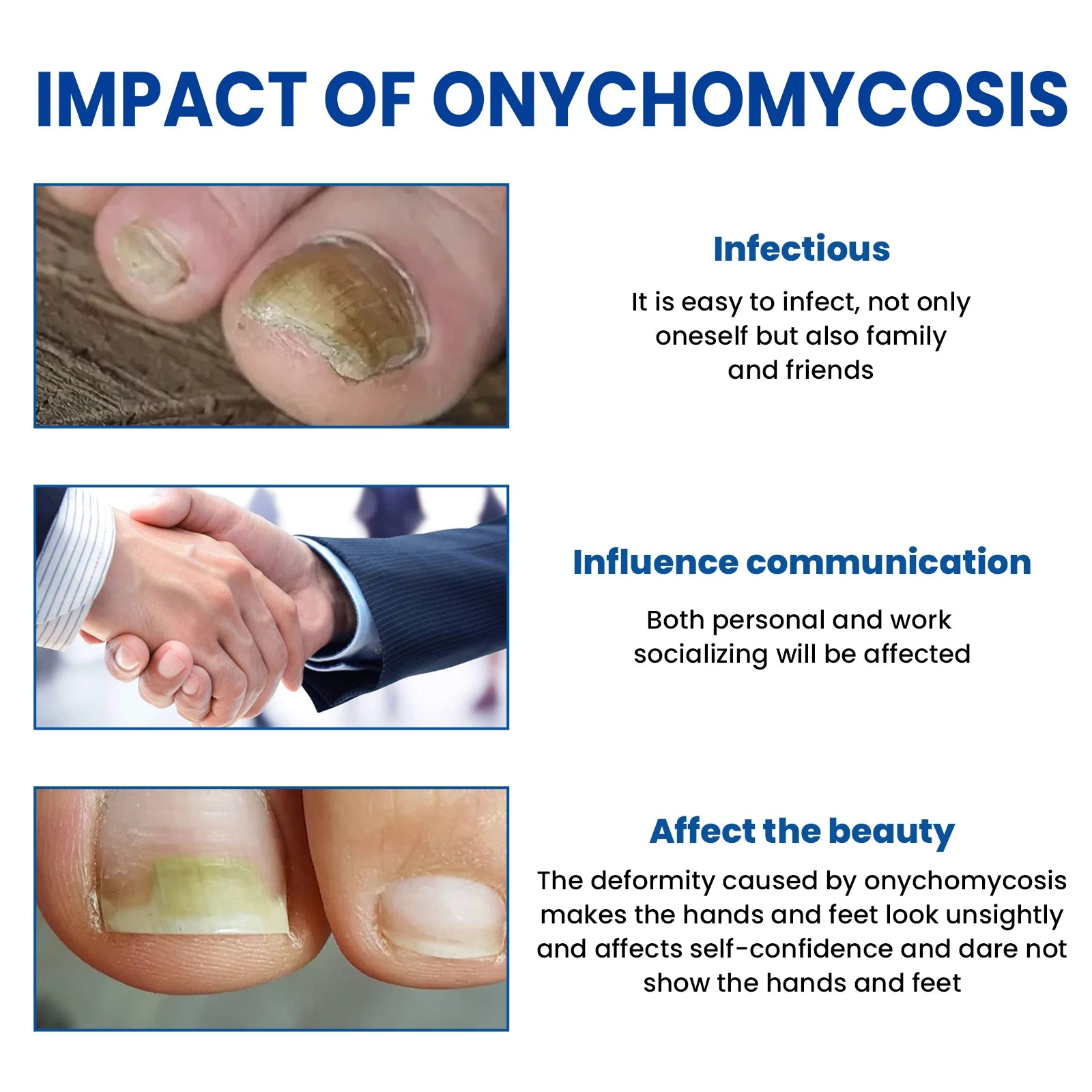 RestoreNail™ — Effortless Healing for Nails That Spark Confidence and Strength