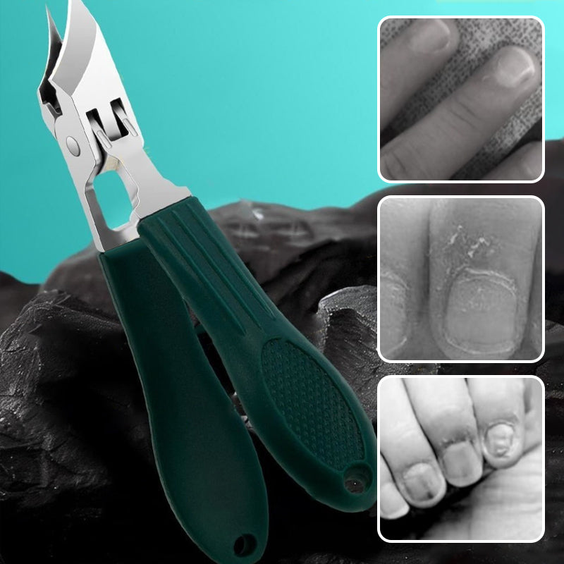 RazorSharp™ Nail Trimming Set — Experience Perfectly Clean Nails Without the Mess or Hassle