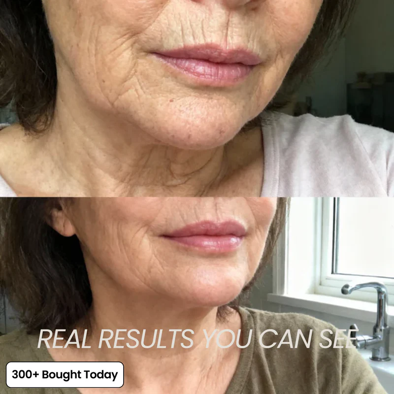 Her+ Calcium™ — Swipe Away Wrinkles, Smile Lines & Tired Under-Eyes In Seconds