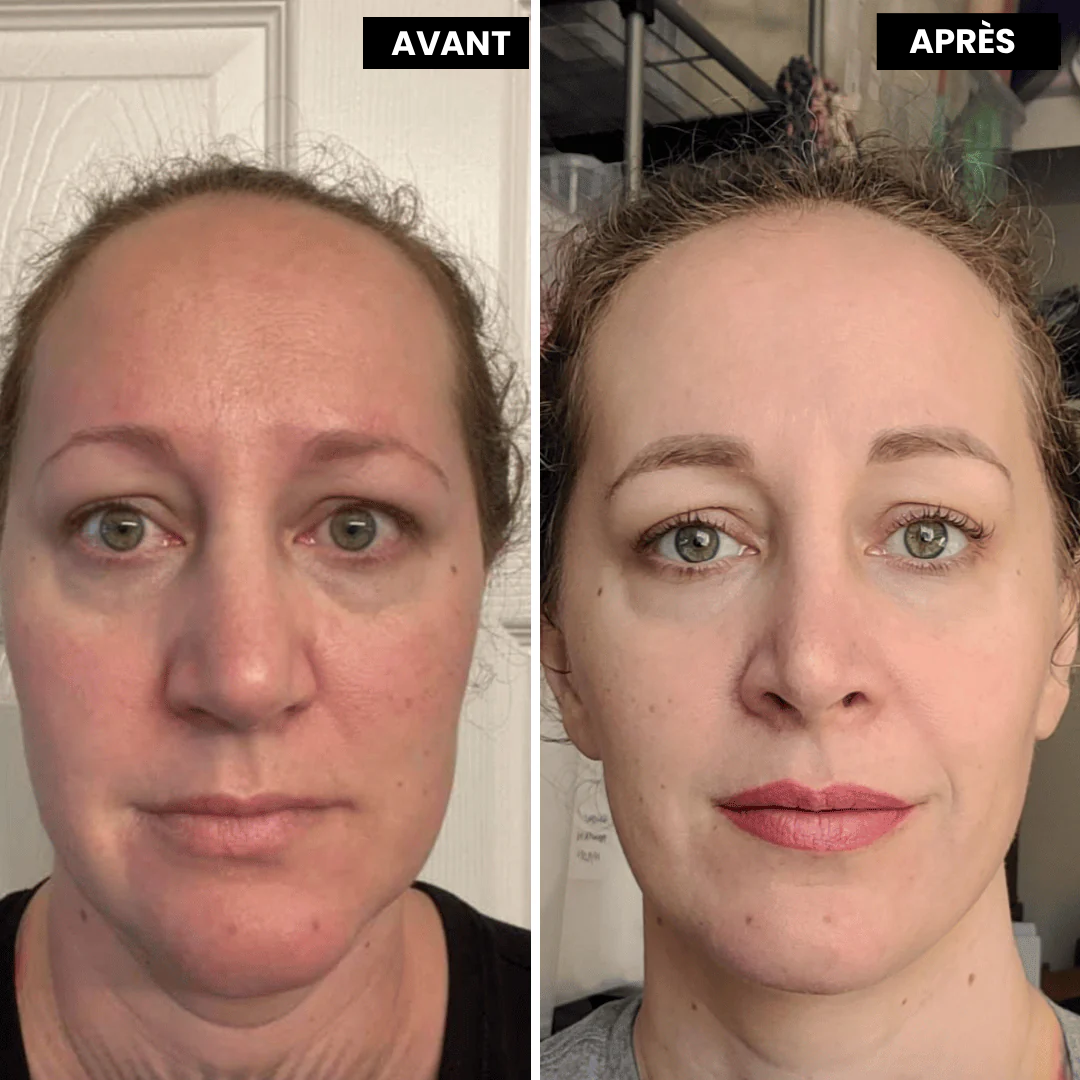 VitaFirm™ Duo — Unlock Firm, Radiant Skin That Turns Back Time