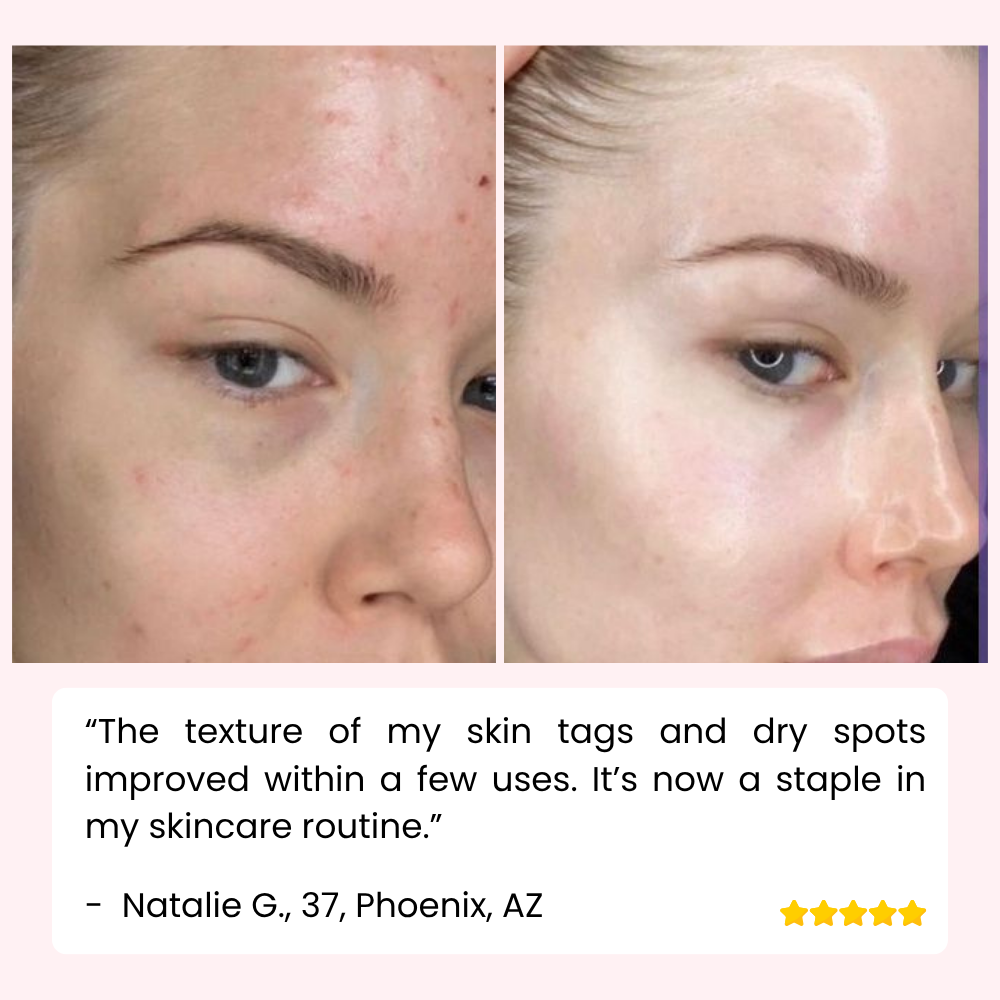 RevitaDerm™ — Unleash Radiant, Silky Skin and Banish Flaws for Good