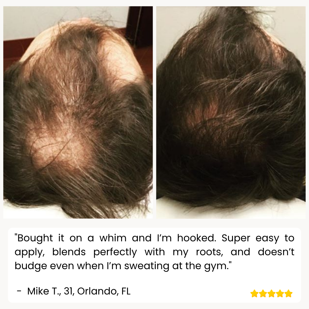 ThickFuse™ — Explode Your Hair’s Fullness and Confidence Instantly