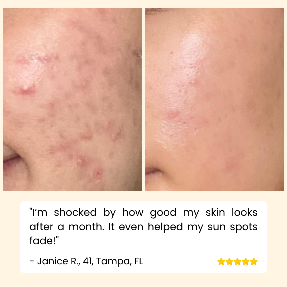 EELHOE Eternity™ — Erase Dark Spots, Reveal Glowing Skin | 1+1 FREE