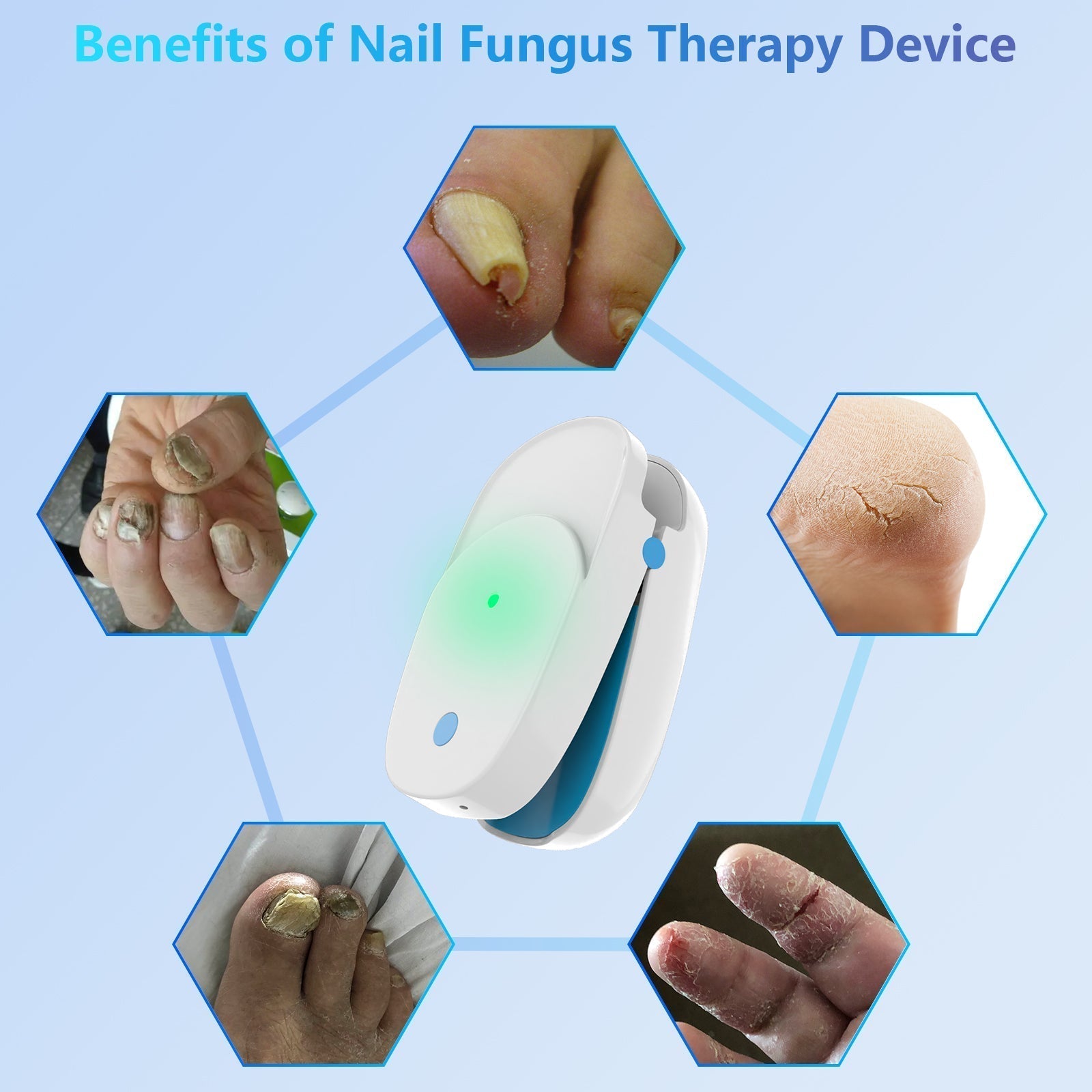 Portable Laser Therapy Device for Nail Cleaning - FDA Cleared