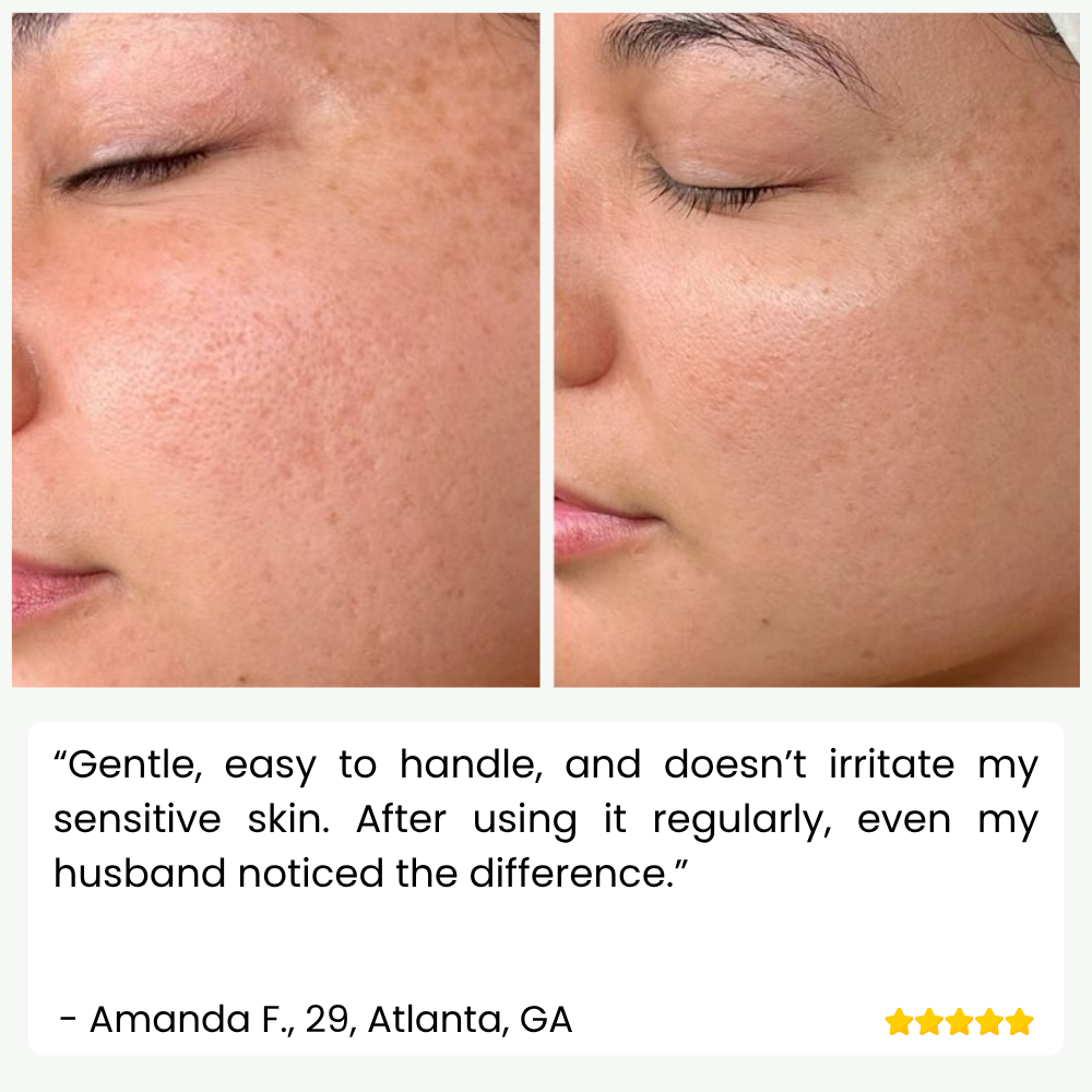 SkinPulse™ - Professional Ultrasonic Skin Cleansing