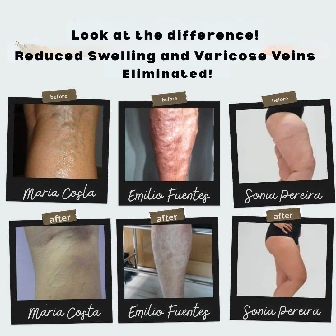 VenoVibe™ — Wake Up Legs That Feel Light, Energized, and Pain-Free All Day