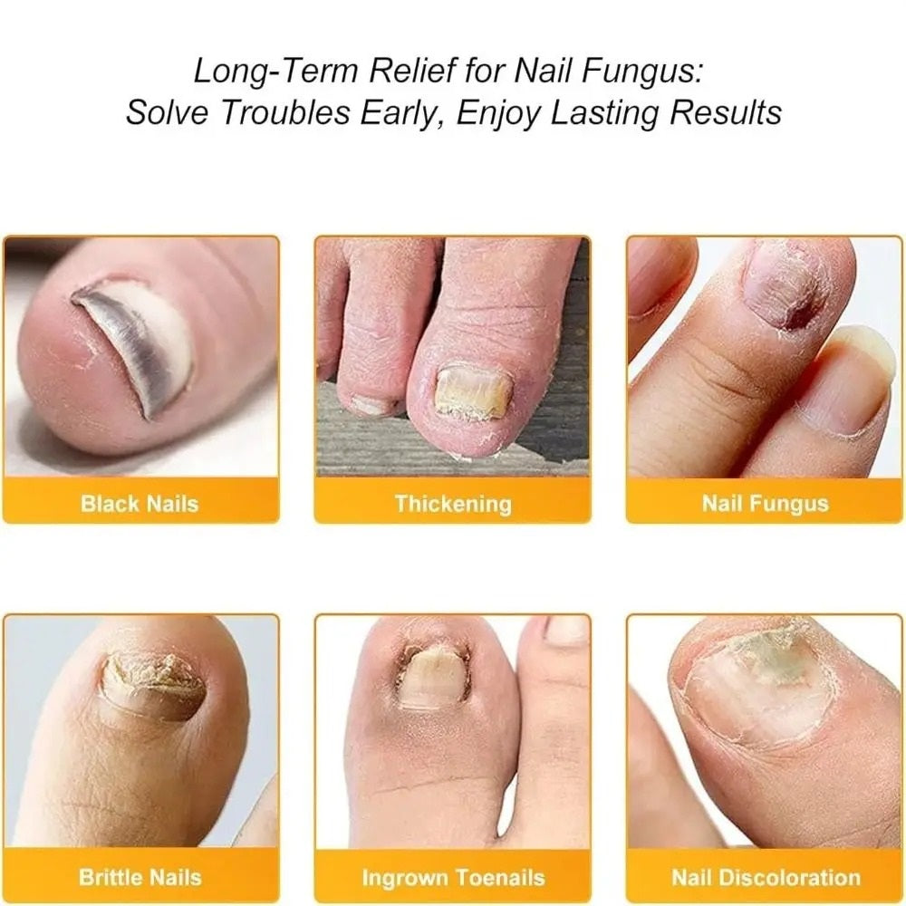 NailVanta™ — Clear, Strong Nails That Boost Your Confidence Every Day