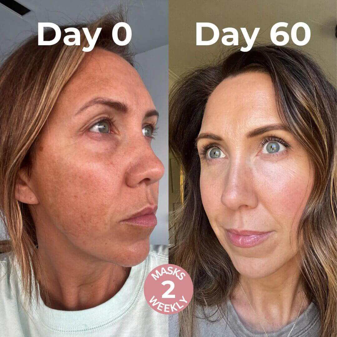 noirwild Bio Collagen Mask™ — Wake Up to Firmer, Radiant Skin That Commands Attention