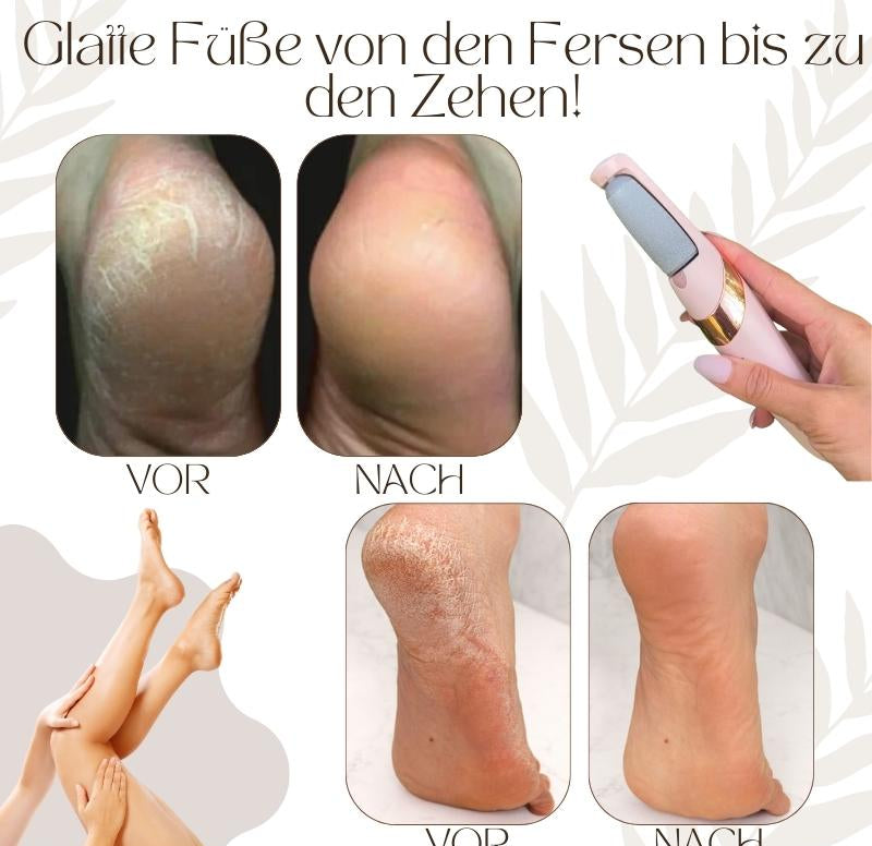 SoleRadiance™ — Unlock Baby-Soft Feet You’ll Proudly Show Off Every Day