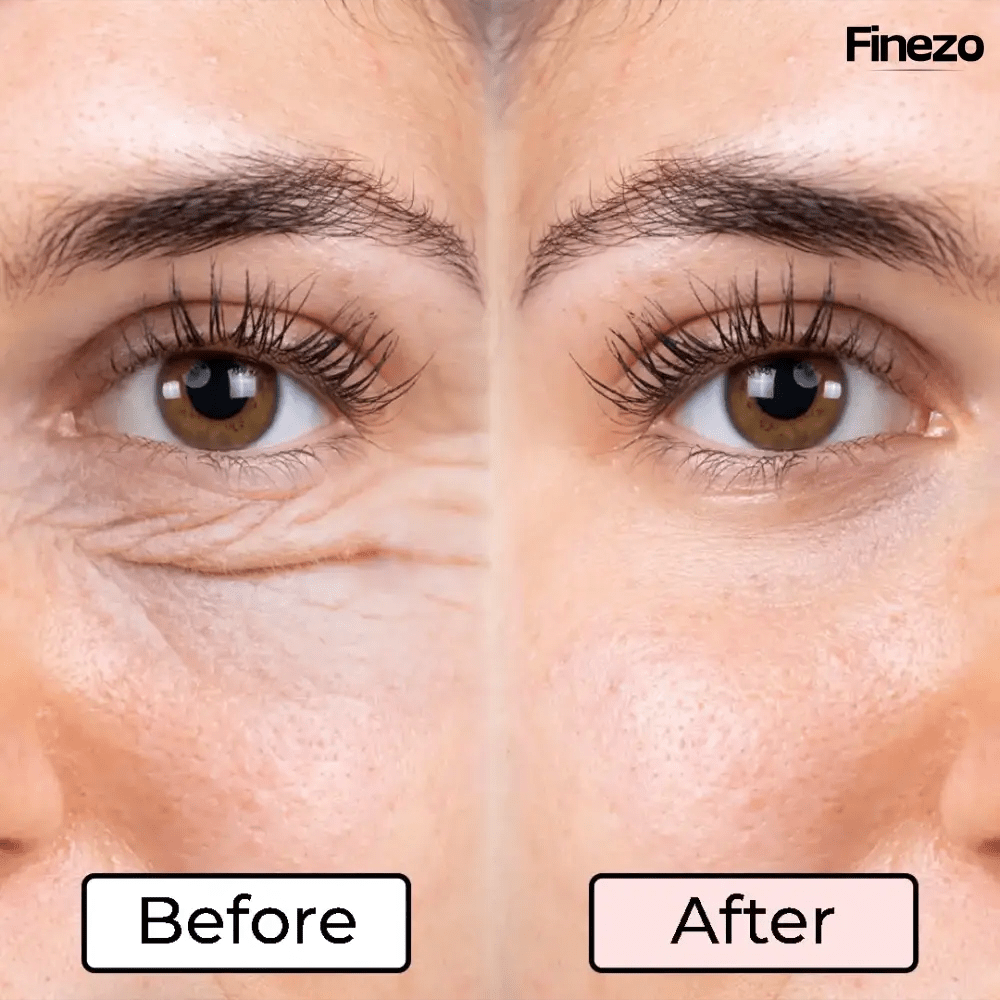 RevitaVue™ — Instantly Revive Tired Eyes and Reveal Youthful Radiance