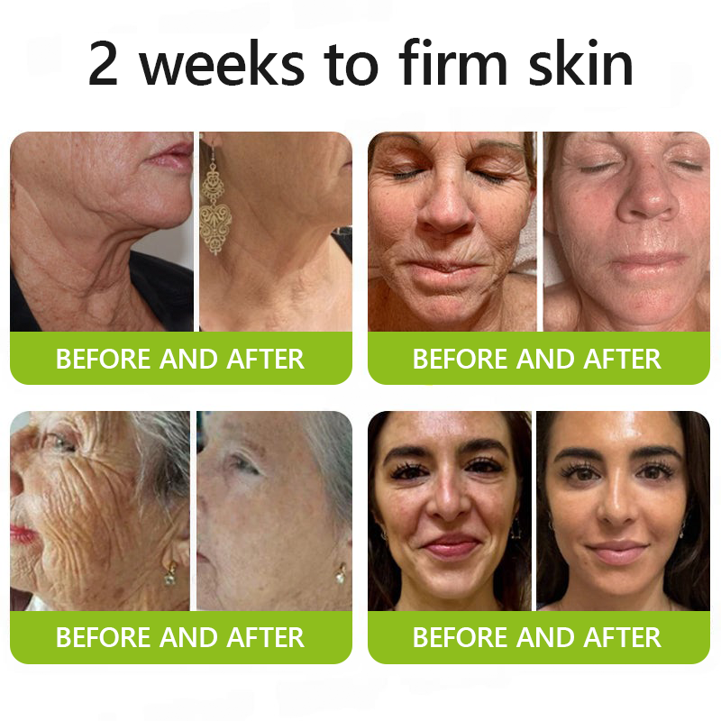 ReviRadiance™ — Unlock Youthful Lift and Radiance Without Needles or Waiting