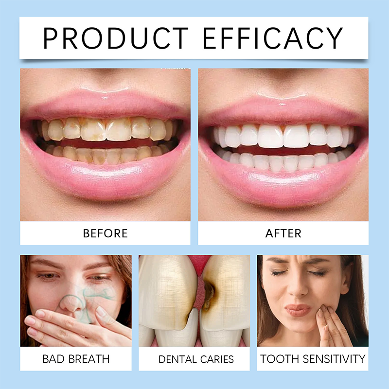 ShineGuard™ — Instant Enamel Strength & Sensitivity Relief for Unstoppable Smiles