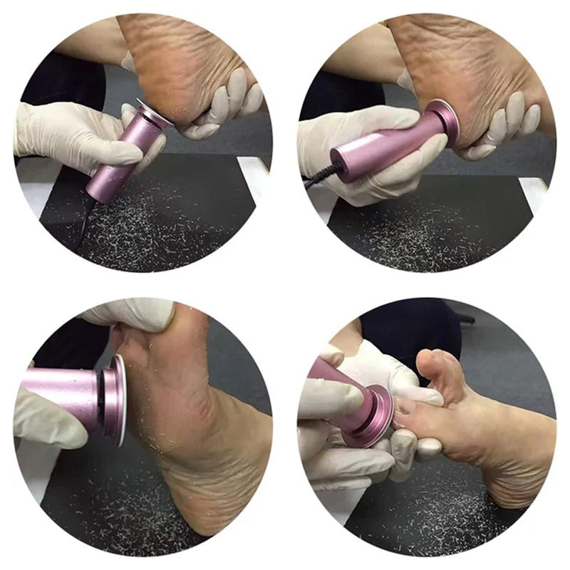 SilkStep Foot Treatment – Transforms Rough Feet into Smooth Comfort