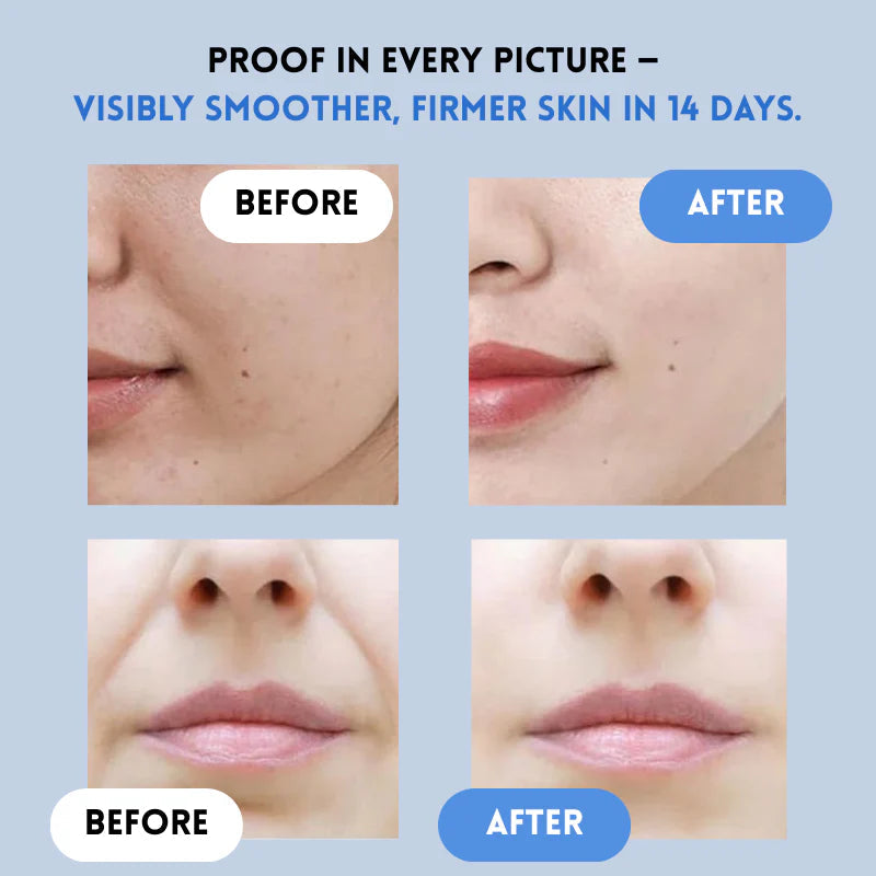 LumaLift™ — Instantly Rewind Time with a Youthful, Radiant Glow