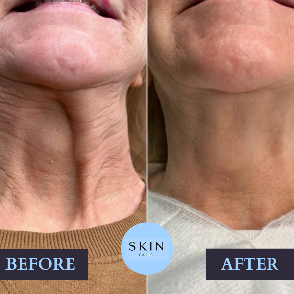 GloraLift™ — Reveal Radiant, Youthful Skin That Turns Heads Every Day