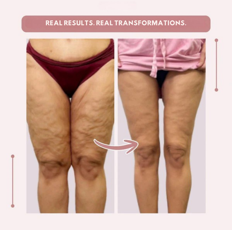 LegSculpt™ — Energize Every Step with Lasting Leg Comfort and Confidence