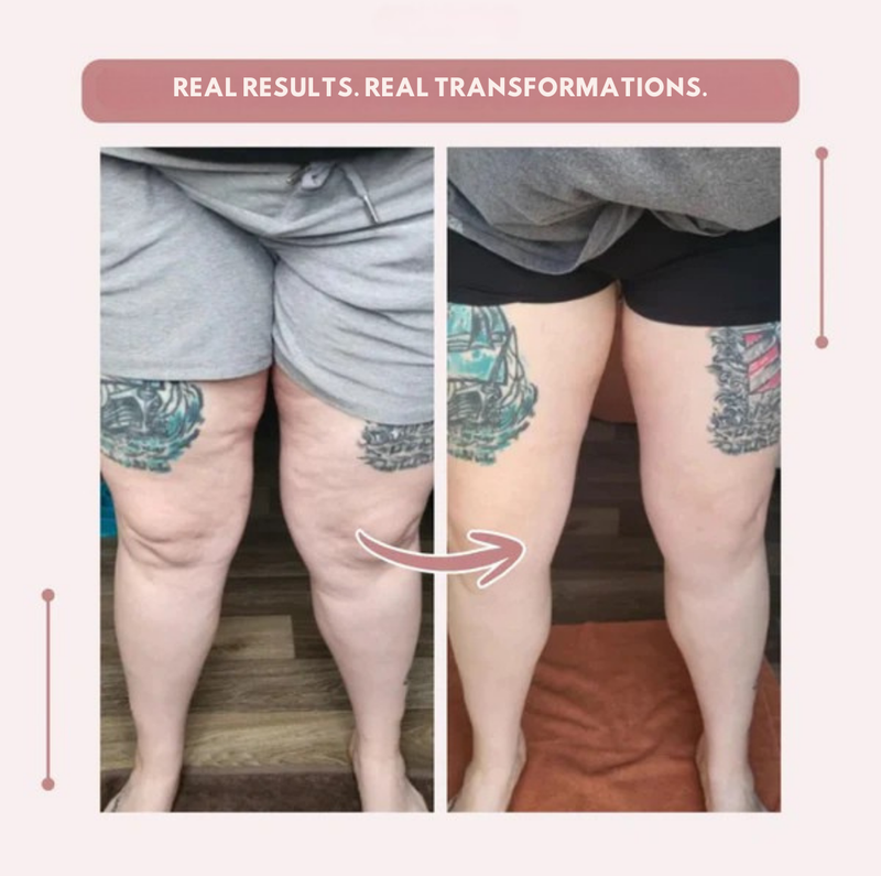 LegSculpt™ — Energize Every Step with Lasting Leg Comfort and Confidence