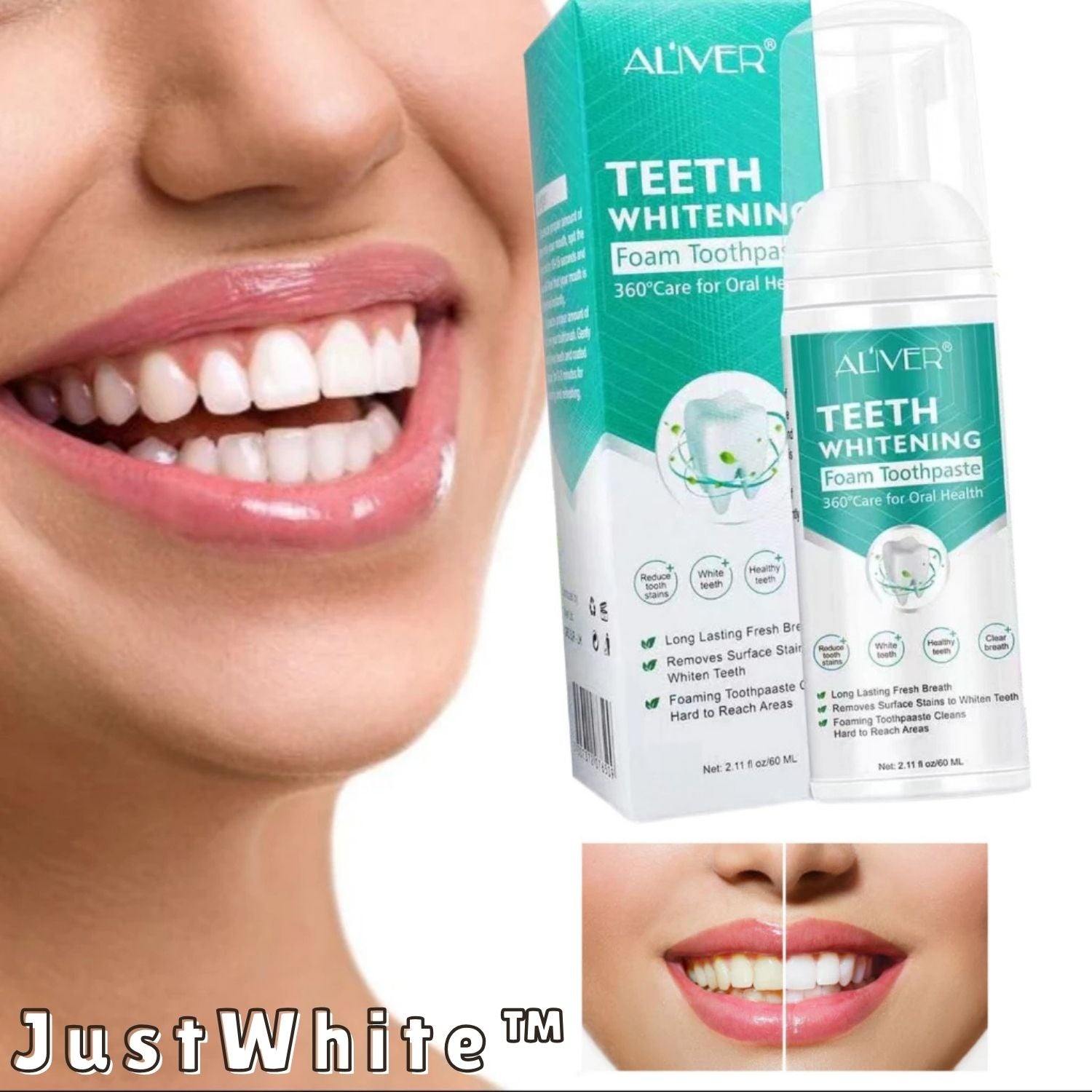 LumaBright™ — Effortless Whitening That Boosts Your Confidence Instantly