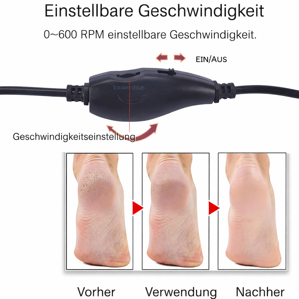 Instantly Smooth Feet with SilkStride – No Pain or Effort Required