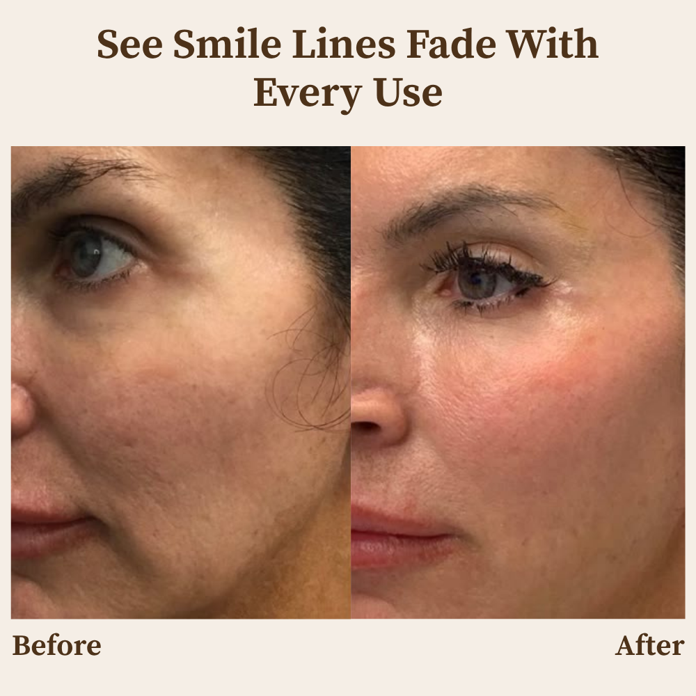 RamoraLift™ — Reveal Youthful, Radiant Skin That Defies Time Instantly