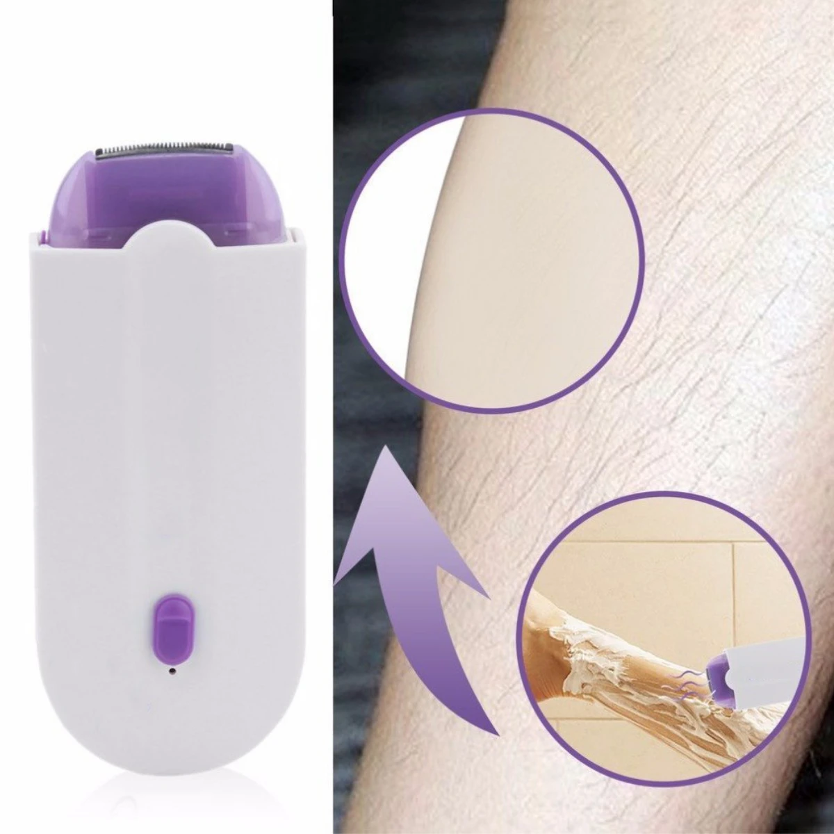 Benice Pro Hair Removal Device
