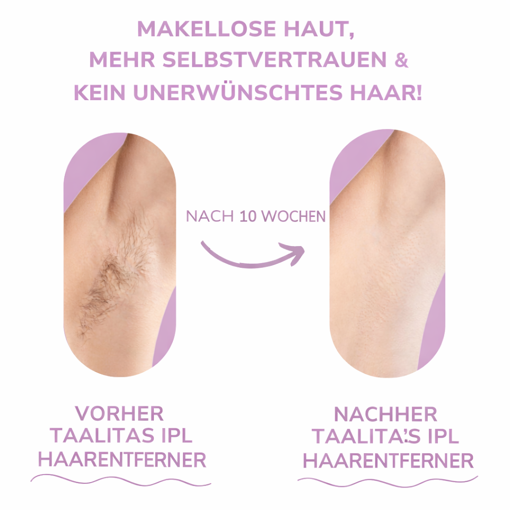 SilkLume X – Smooth Skin for Weeks, Pain-Free