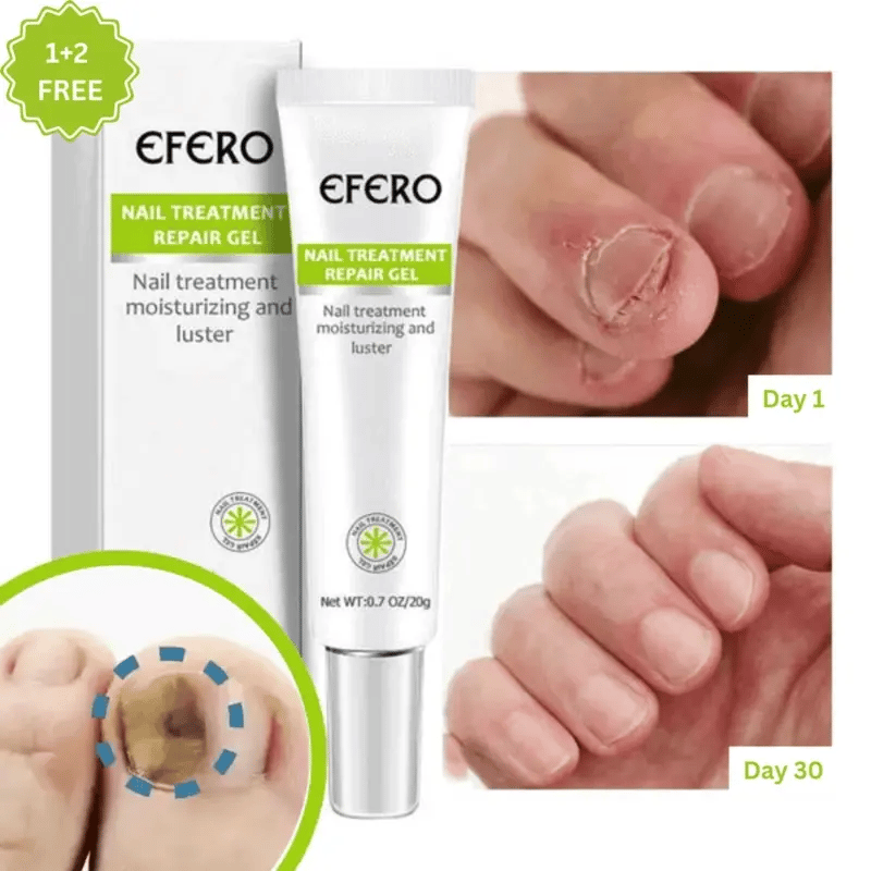 Efero® Nail Repair Gel: 1 + 2 FREE TEMPORARY OFFER