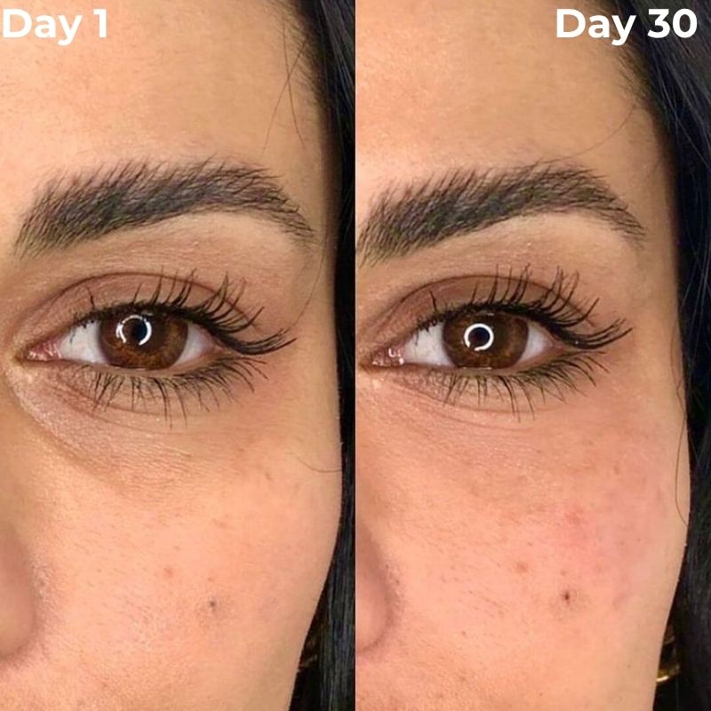 Red Light Therapy Device for Under Eye Treatment at Home