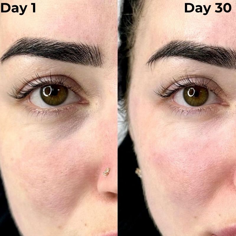 Red Light Therapy Device for Under Eye Treatment at Home