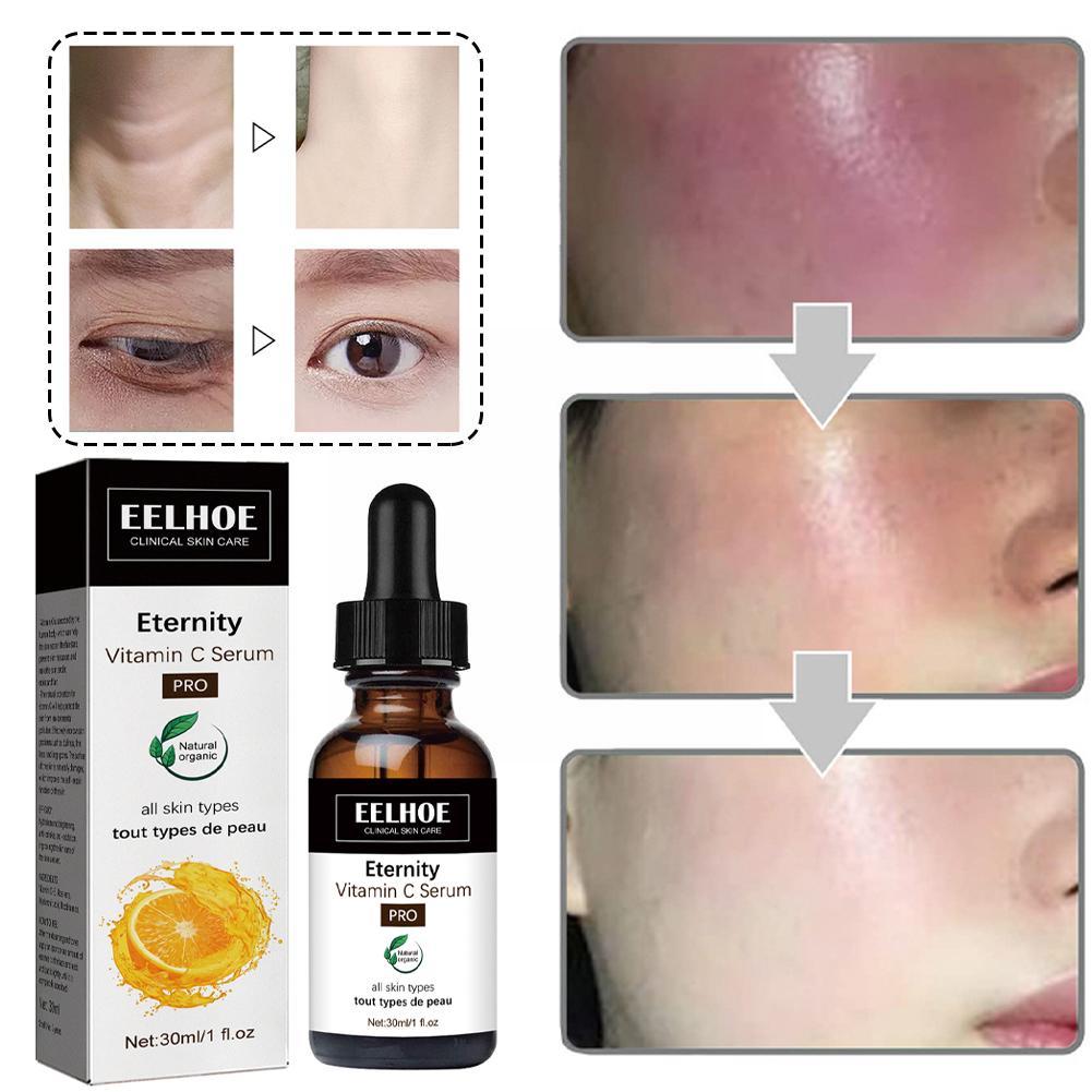 EterniGlow™ — Clear, Radiant Skin Fast | 1+1 Free