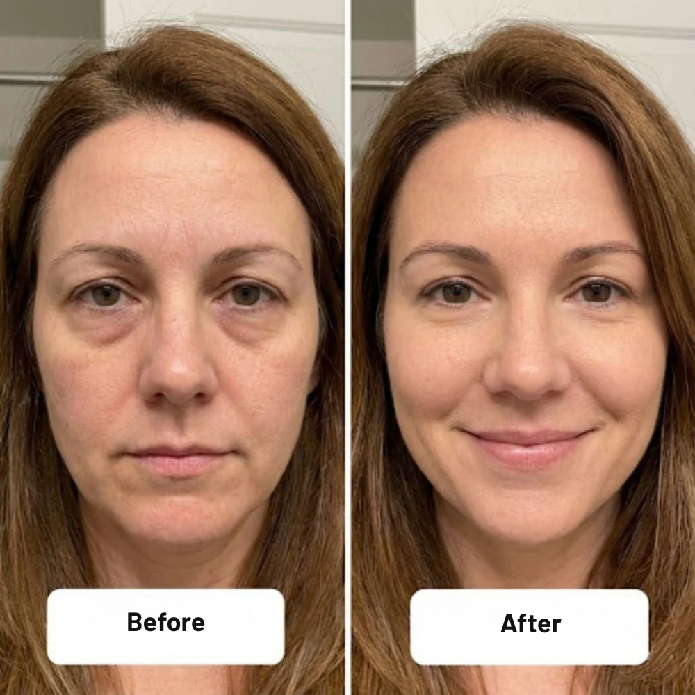 TurboSpark™ — Ignite Instant Power and Never Freeze Your Engine Again