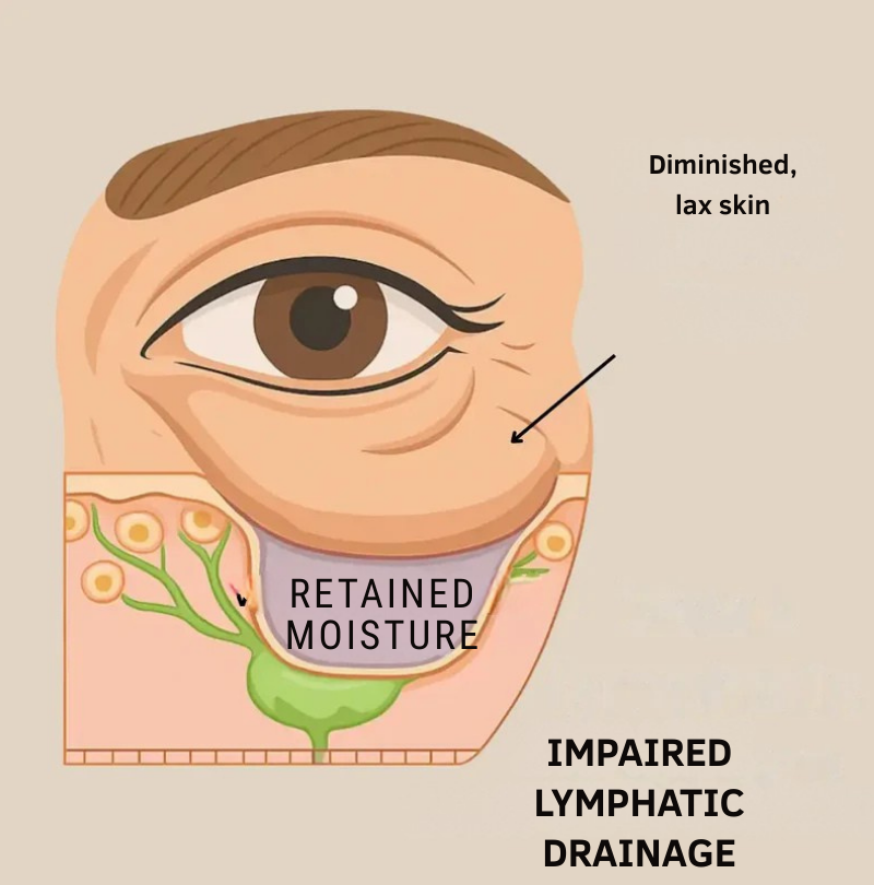 RevitaRay™ — Banish Puffiness Fast for Bright, Youthful Eyes That Spark Confidence