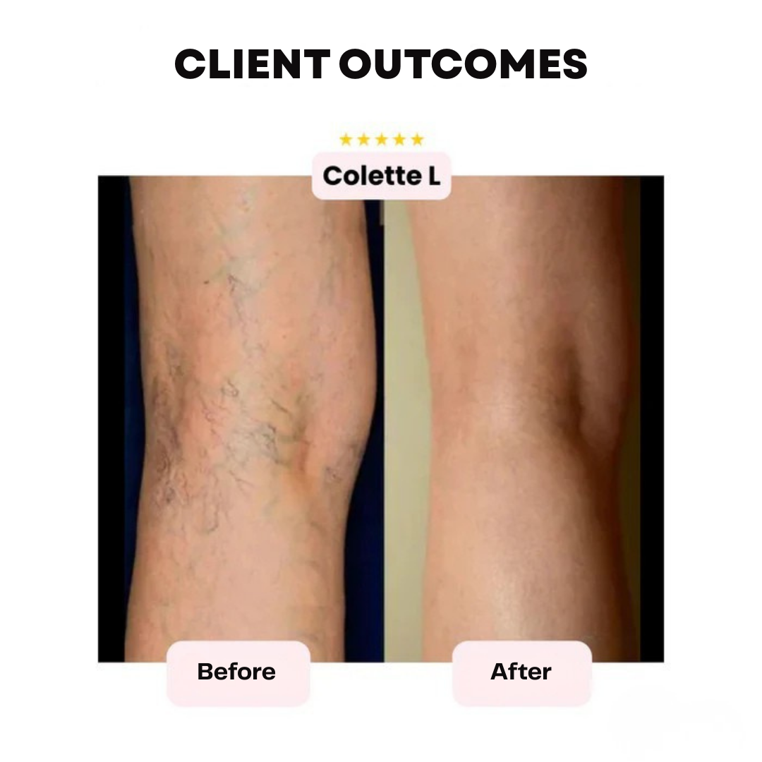 RadianceVeil™ — Unleash All-Day Flawless Skin and Fearless Confidence