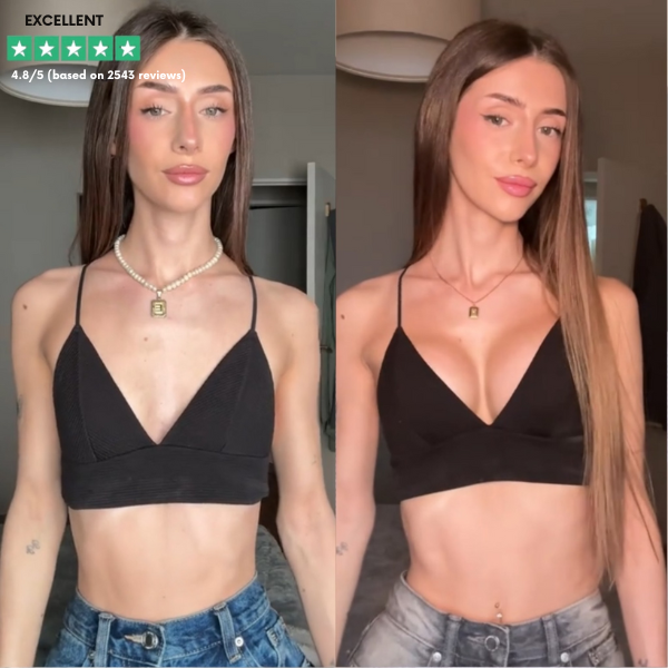 EmbraceContour™ — Wake Up to Naturally Fuller, Firmer Breasts Without Surgery