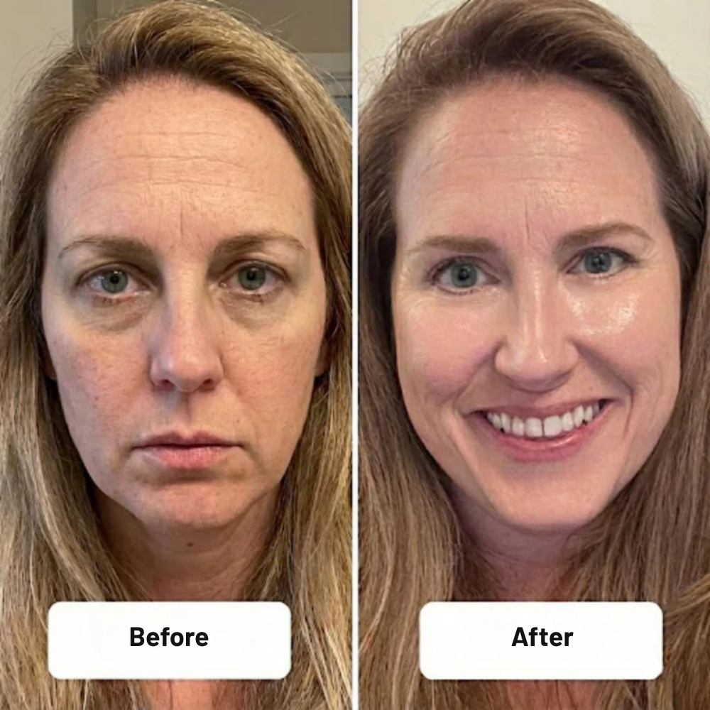 TurboSpark™ — Ignite Instant Power and Never Freeze Your Engine Again