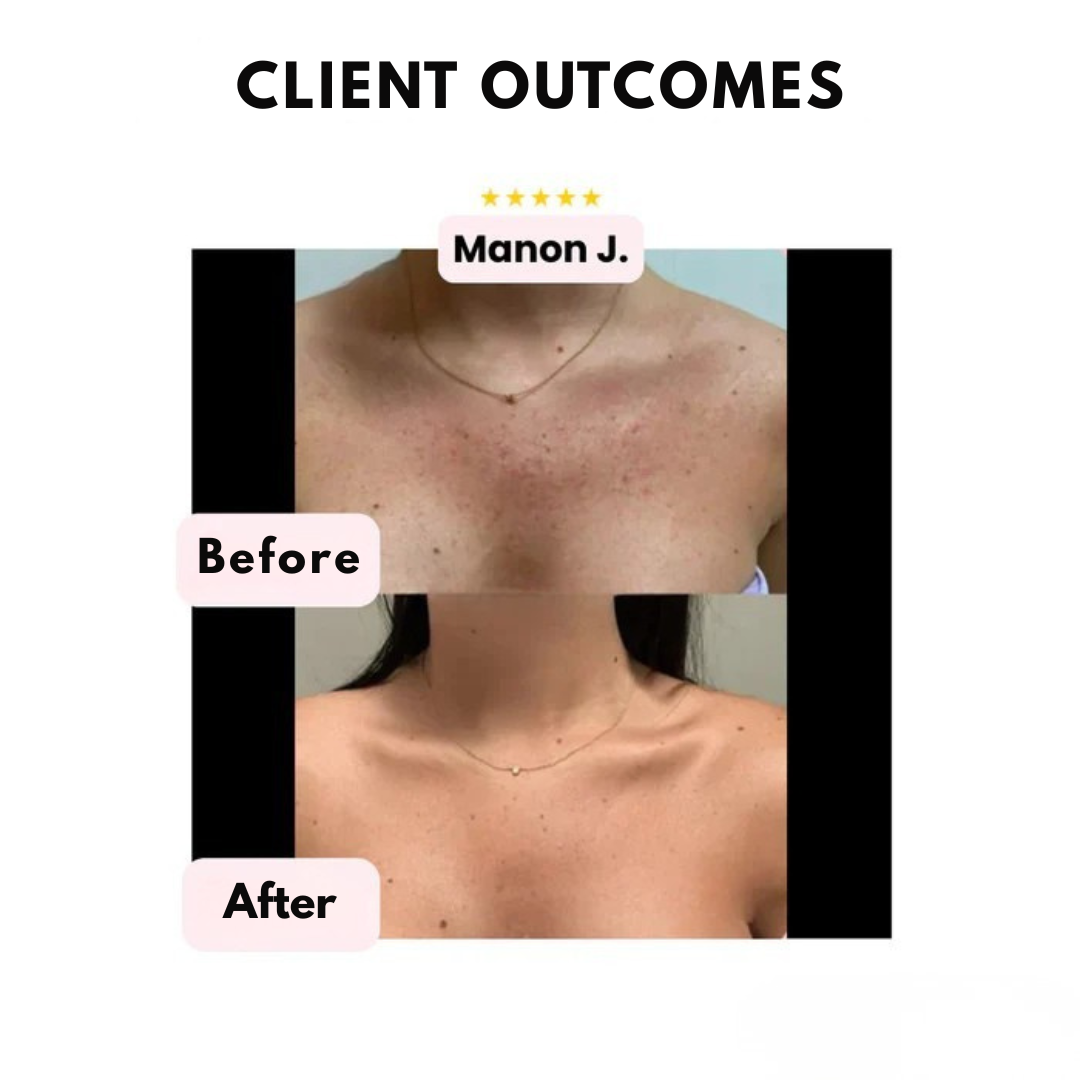 RadianceVeil™ — Unleash All-Day Flawless Skin and Fearless Confidence