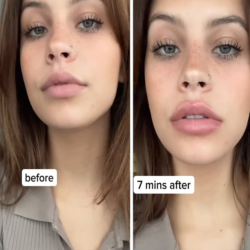 KissBeauty™ — Plump Lips, Hydrated Confidence Instantly | 50% Off