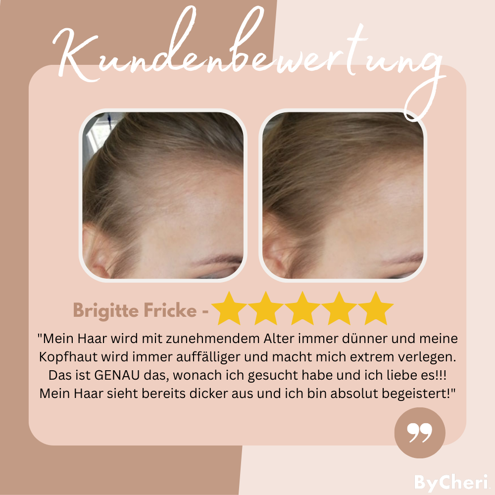 EasyBlend - Bye-Bye Hairline | 1+1 FREE ONLY TEMPORARY