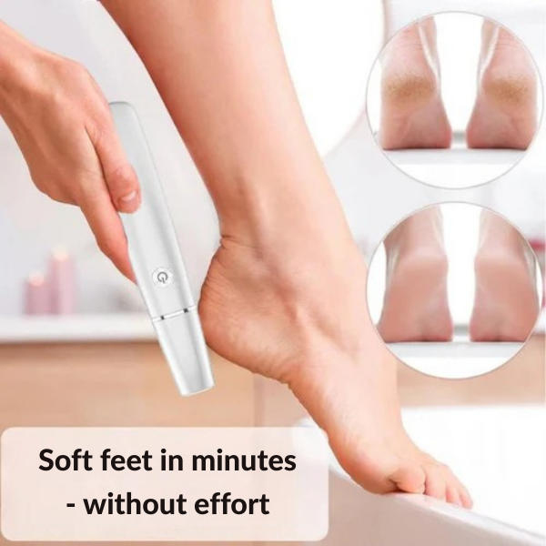 GlideStep™ — Instantly unleash irresistibly soft, pain-free feet that steal the spotlight