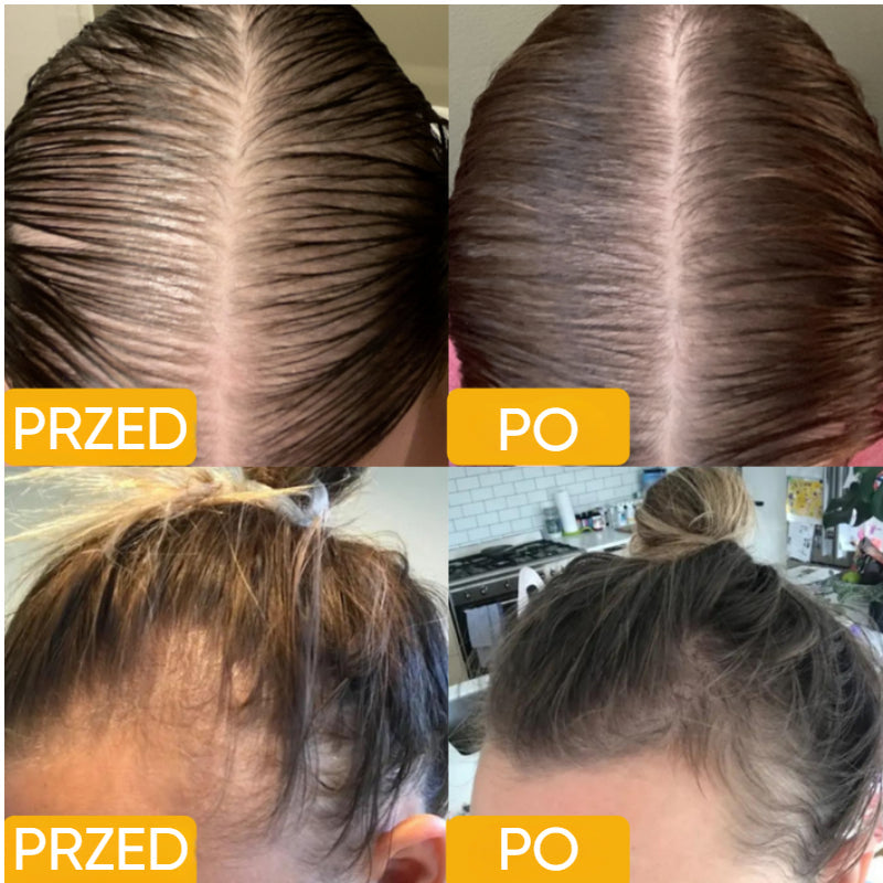 EELHOE Veghair™ Vegan Natural Hair Growth Oil