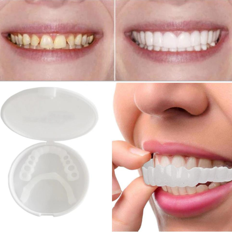 SnapBright™ — Smile Instantly with Natural-Looking Veneers | 50% Off Today