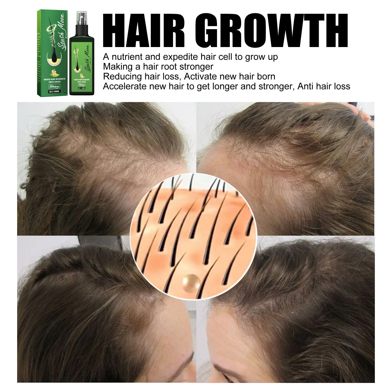 GrowthPlus Nourishing Ginger Spray