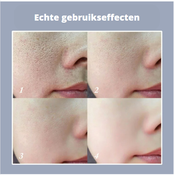 Zenvada™ Magical Pore Remover — Instant Poreless, Matte Perfection | 1+1 Free