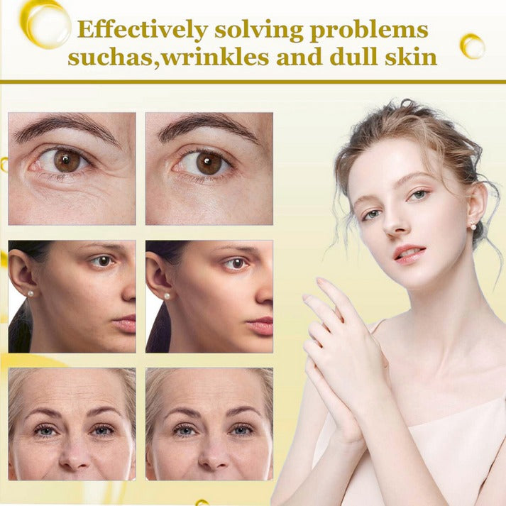 VLyft™ | Sculpt your V-line in minutes, no surgery needed!