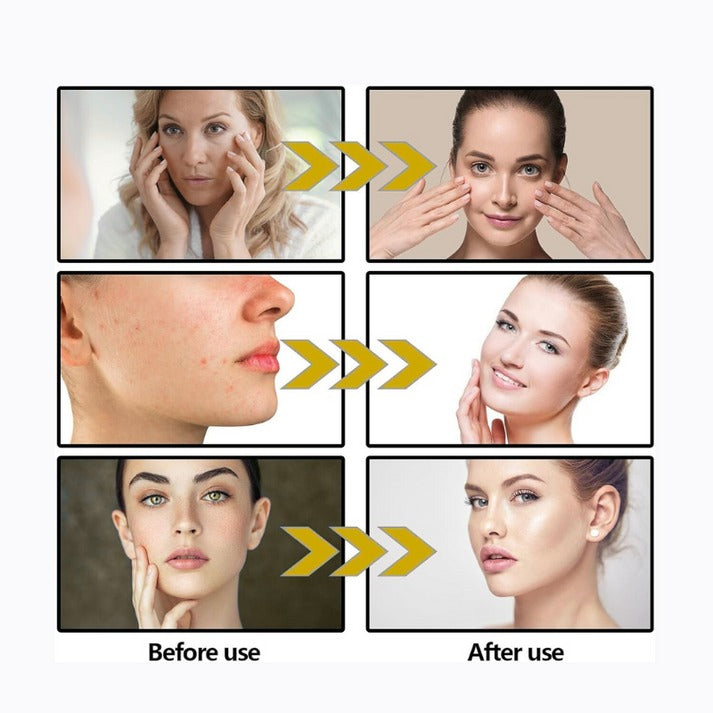 VLyft™ | Sculpt your V-line in minutes, no surgery needed!