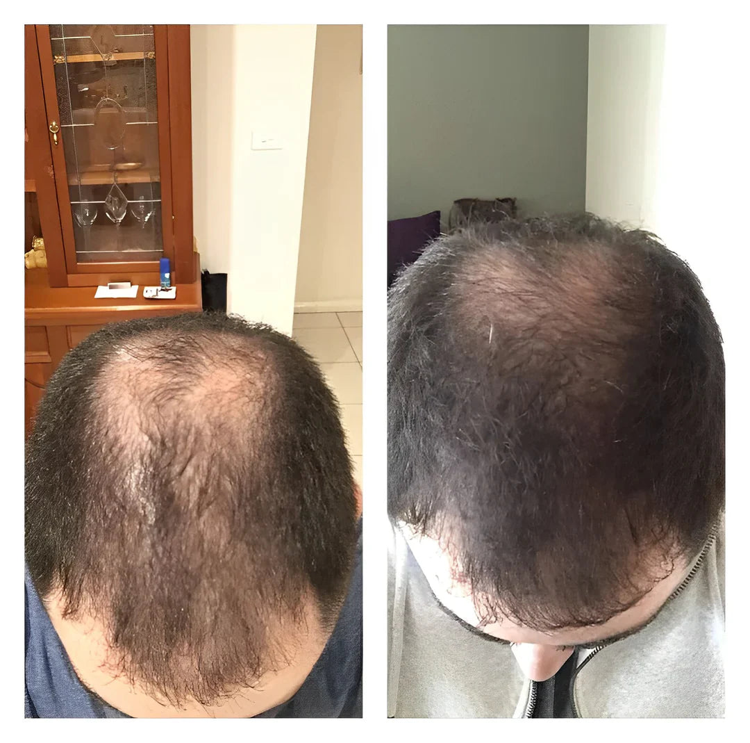 1+1 FREE | RiceGlow™ - Anti-Hair Loss (Last Day Discount)