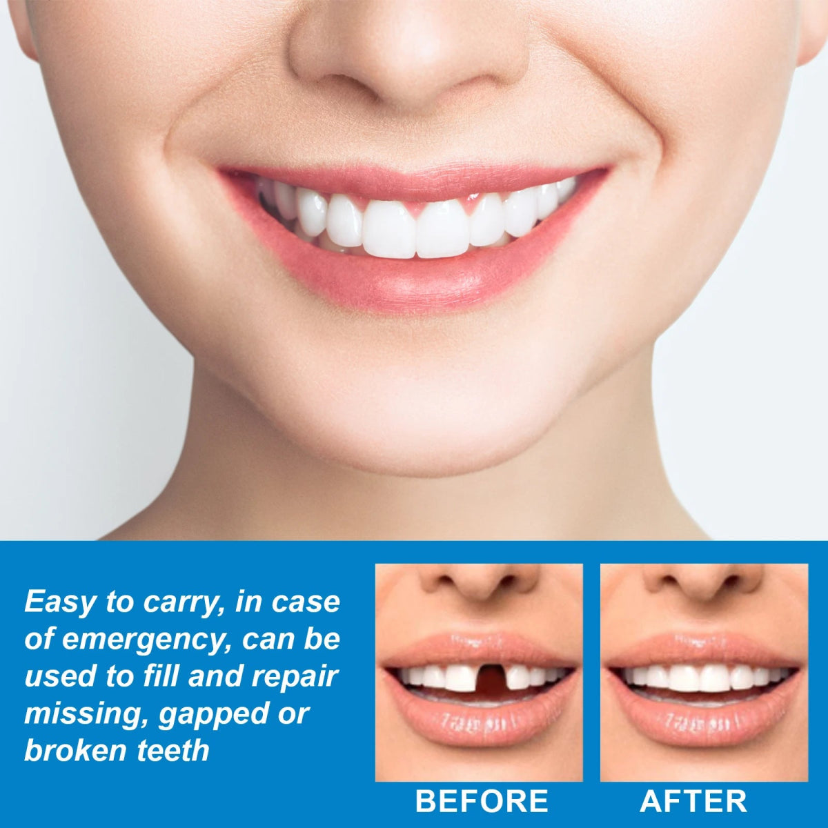 InstantSmile™ — Confidently Fill Gaps and Shine Bright Anywhere, Anytime